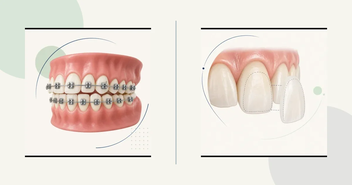 Same decision, braces phrasing comparison graphic
