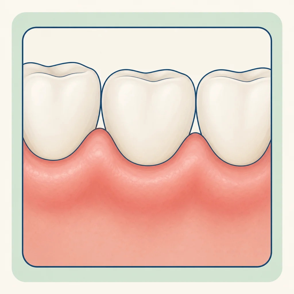 Swollen Gums dental educational illustration